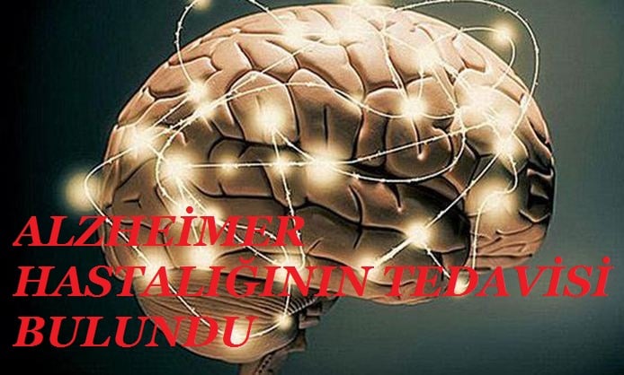 alzheimer hastaliginin tedavisi bulundu