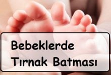 bebeklerde tırnak batması