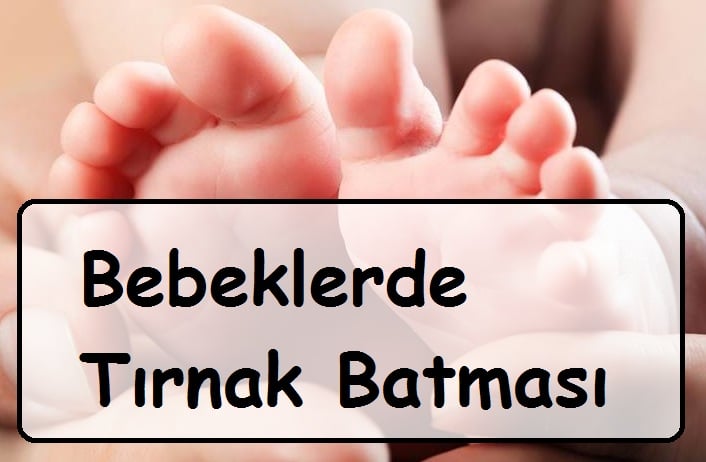 bebeklerde tırnak batması