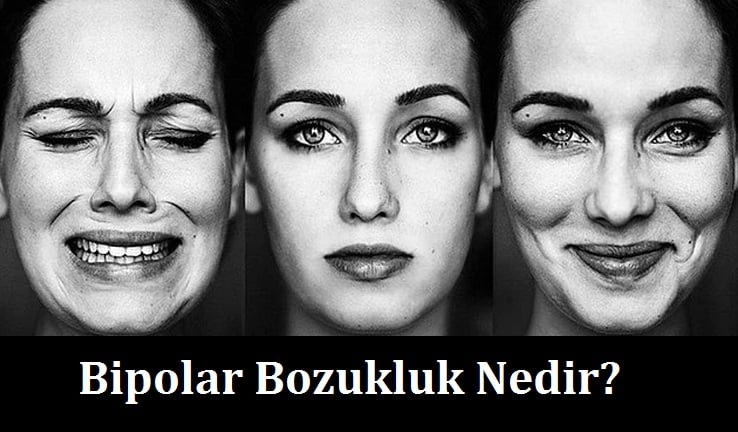 bipolar bozukluk nedir