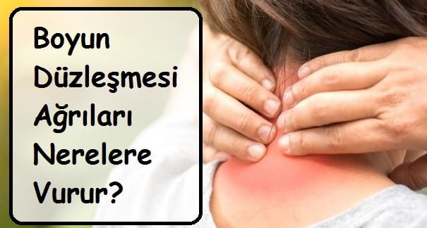 Boyun Düzleşmesi Ağrıları Nerelere Vurur