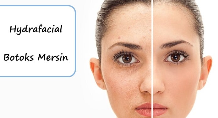 Hydrafacial & Botoks Mersin