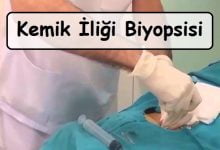 kemik iliği biyopsisi