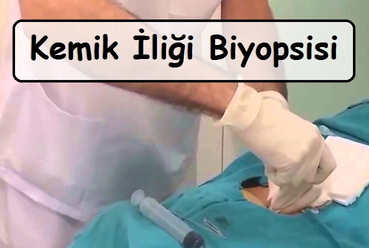 kemik iliği biyopsisi