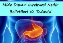 Mide Duvarı İncelmesi Nedir, Belirtileri Ve Tedavisi