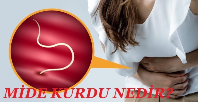 mide kurdu nedir