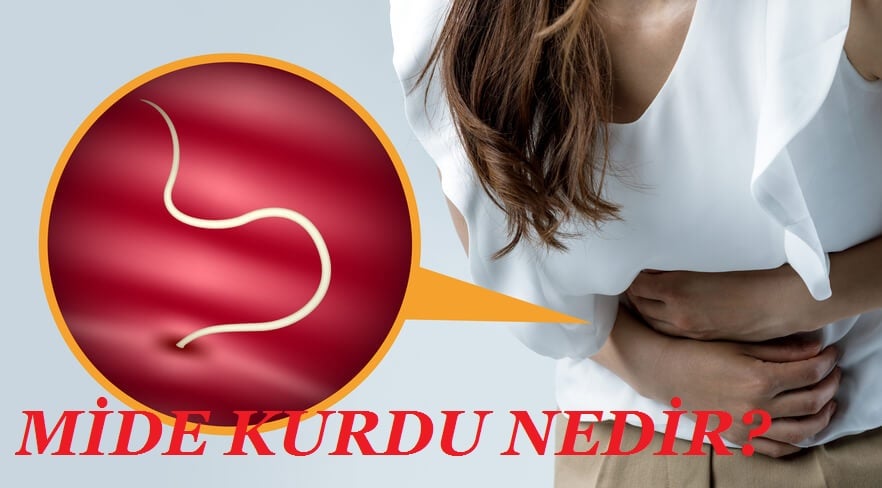 mide kurdu nedir