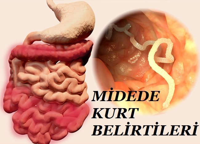 midede kurt belirtileri