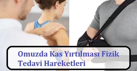 Omuzda Kas Yırtılması Fizik Tedavi Hareketleri