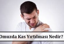 Omuzda Kas Yırtılması Nedir