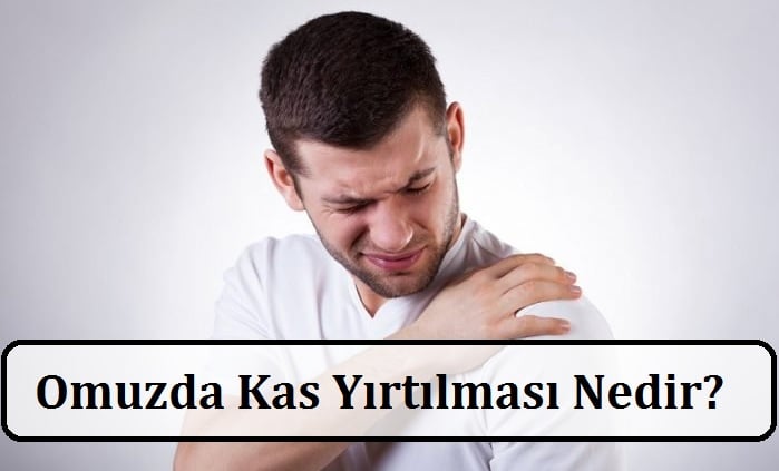 Omuzda Kas Yırtılması Nedir