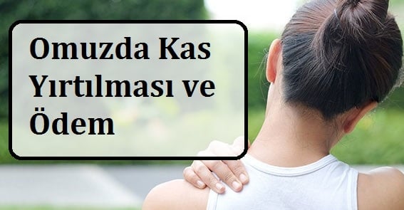 Omuzda Kas Yırtılması ve Ödem