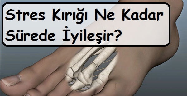 Stres Kırığı Ne Kadar Sürede İyileşir