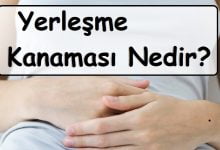 Yerleşme Kanaması Nedir