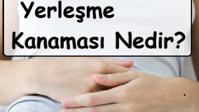 Yerleşme Kanaması Nedir